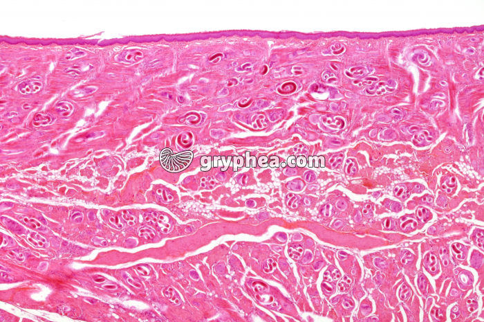 Trichines - Vers parasites (Trichinella spiralis) dans un muscle x10 - gryphea.com